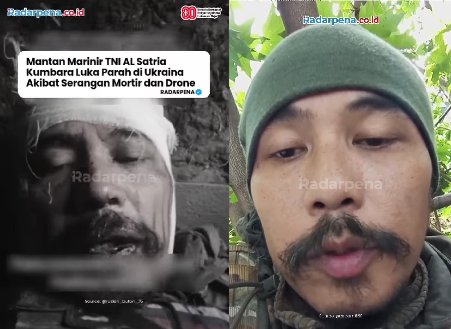 Begini Kondisi Terkini Satria Arta Kumbara, Eks TNI AL Jadi Tentara Bayaran Rusia Usai Dibombardir Mortir