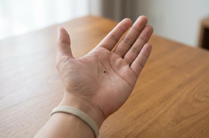 Rahasia Rezeki dan Jodoh: Membedah Makna Tahi Lalat di Tangan Lengkap