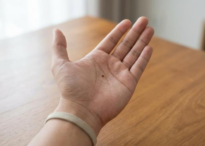 Rahasia Rezeki dan Jodoh: Membedah Makna Tahi Lalat di Tangan Lengkap
