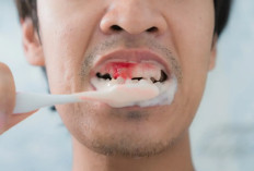 Waspada Gusi Berdarah Saat Sikat Gigi: Pakar Unpad Ingatkan Risiko Penyakit Kronis